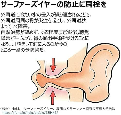 まだサーフィン耳栓使ってないの？音が聞こえるEAR SUITS4をオススメしたい【ムラスポには売ってないサーファーズイヤー対策】